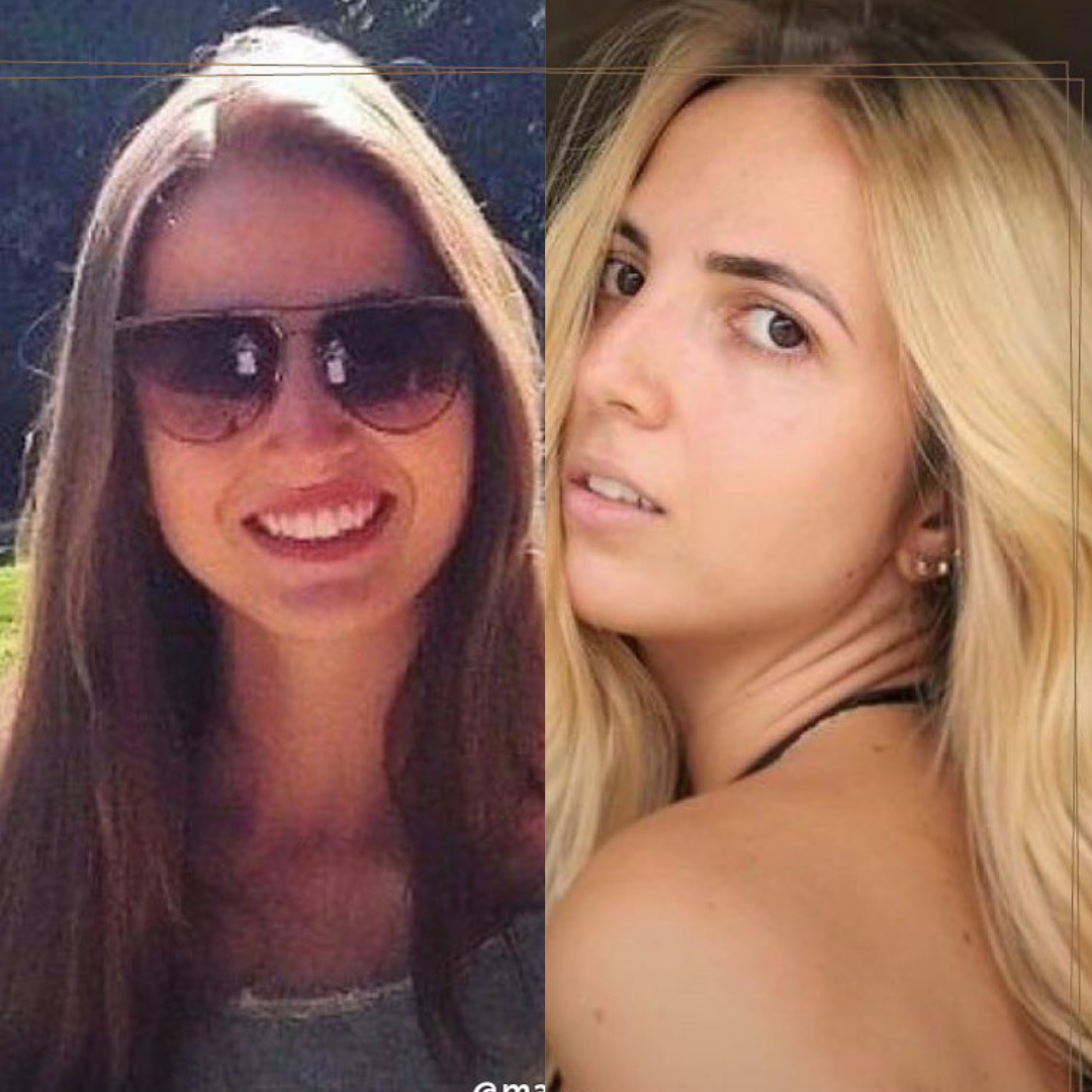 Kit Aclarador Rubio Natural + Fanola