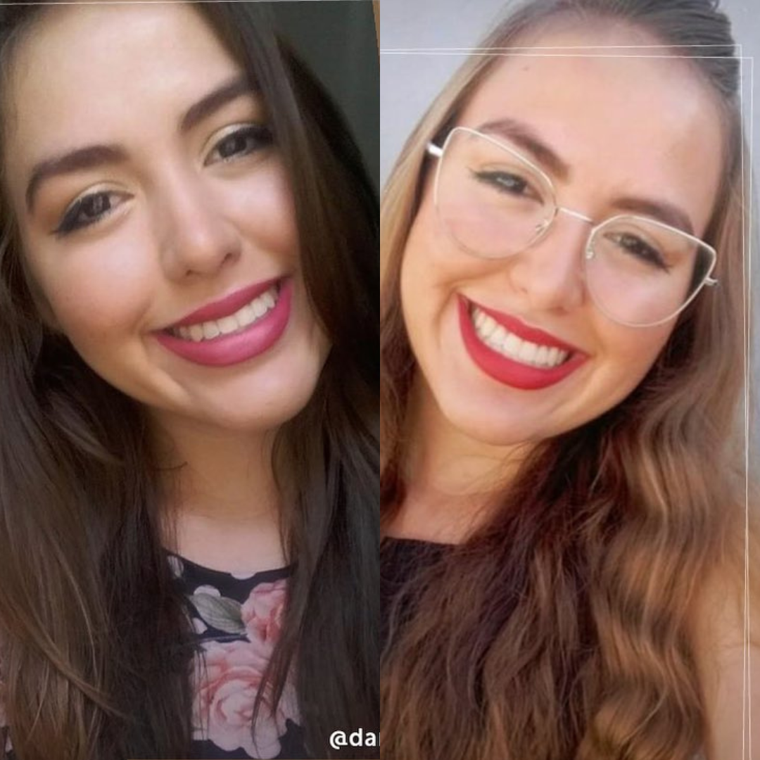 Kit Aclarador Rubio Natural + Fanola